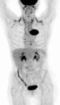 PET Scan — Axial Slice 2