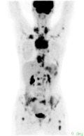 PET Scan — Axial Slice 4