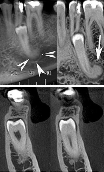 CBCT — Dental View