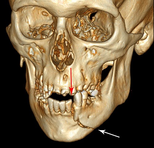 CBCT — 3D Reconstruction