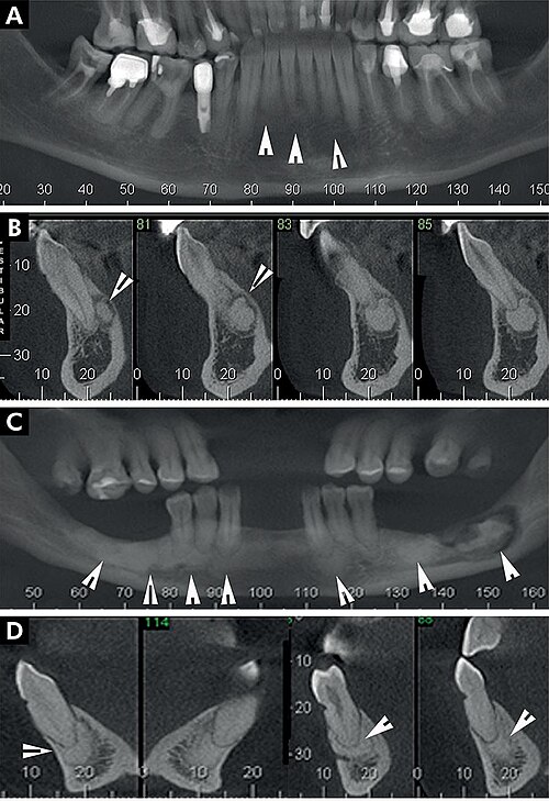 Panoramic — Dental Overview