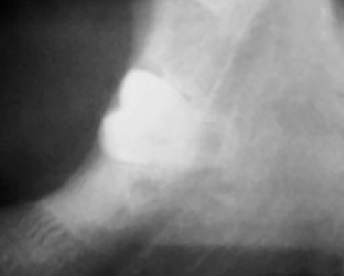 Dental X-ray — Tooth Detail