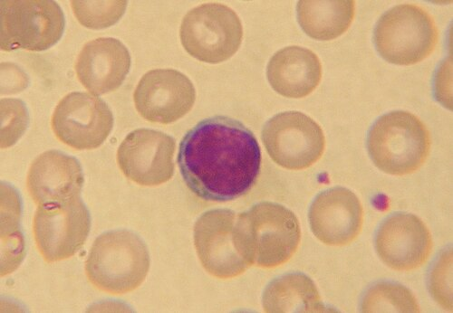 blood_smear__giemsa__063c79cc2127