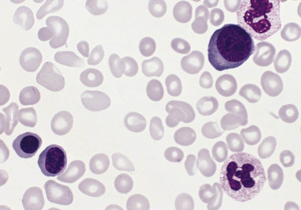 blood_smear__giemsa__2c99ae11f630