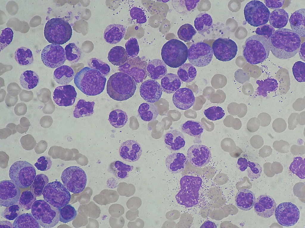 blood_smear__giemsa__49468b67a5b8
