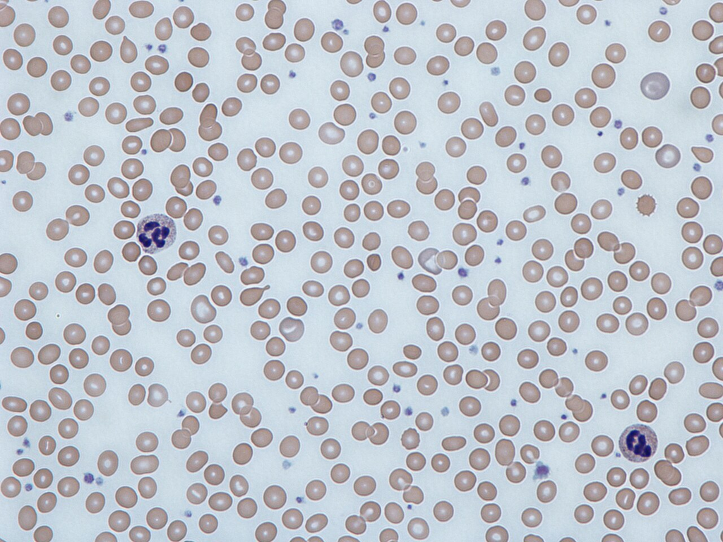 blood_smear__giemsa__69482d898da3
