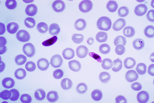 blood_smear__giemsa__6f19535daa73