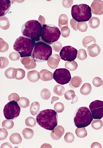 blood_smear__giemsa__d4246b5e235f