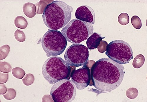 blood_smear__giemsa__f739e8447e94