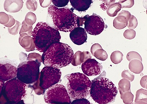 blood_smear__giemsa__faa6723d1945