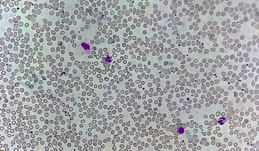 blood_smear__wright__35d9e1d51cef