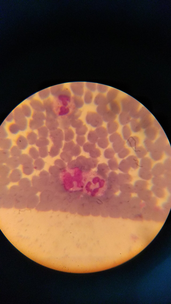 blood_smear__wright__3e7199816972