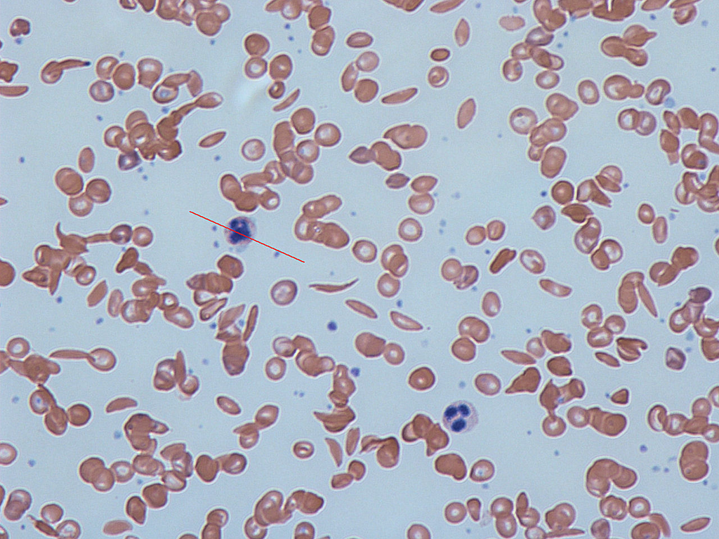blood_smear__wright__53985f14428b