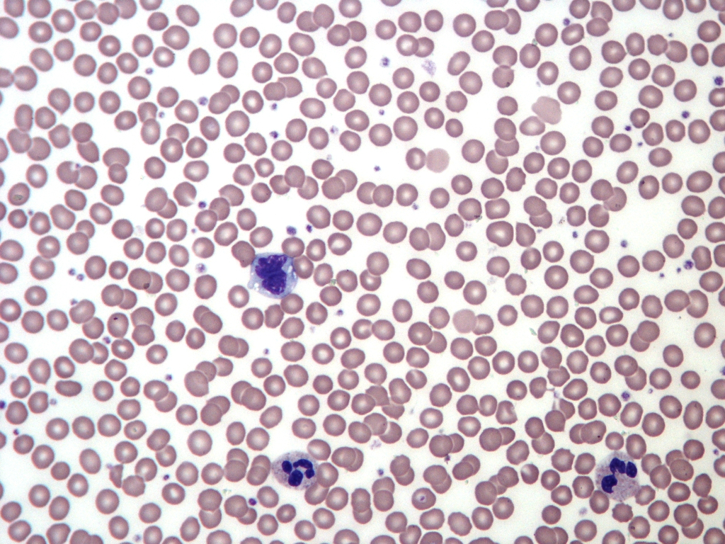 Normal Adult Blood Smear â€” Wright Stain