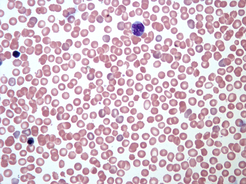 blood_smear__wright__8d119409f041