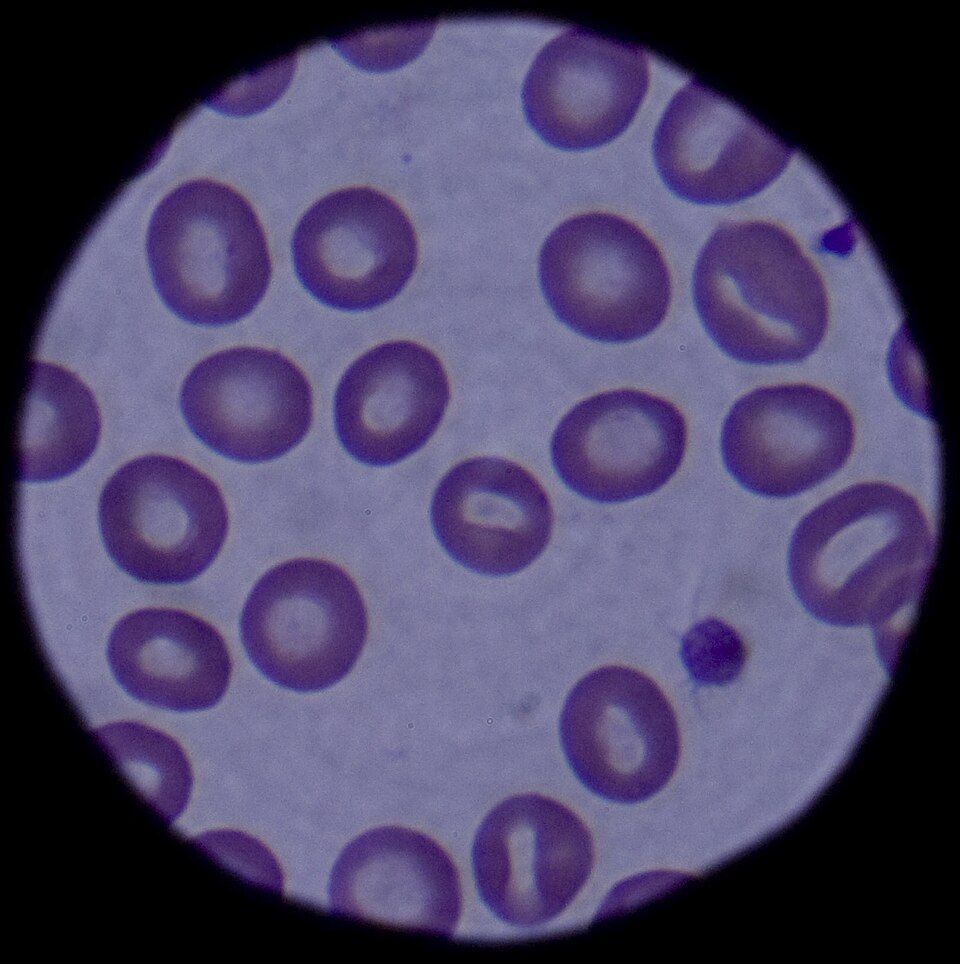 Blood Cells — Clinical Microscopy