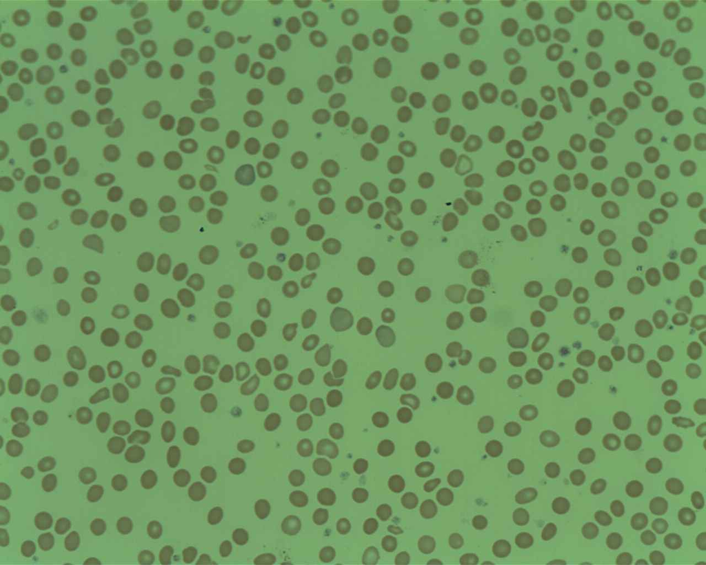 blood_smear__wright__b54ba99a8689