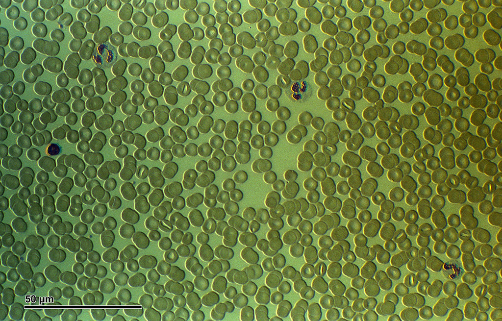 Human Blood Smear — High Resolution