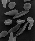 blood_smear__wright__e741b79c1716