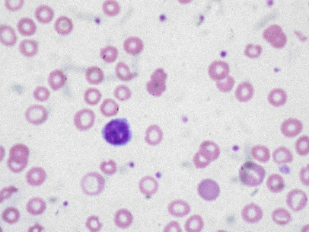 blood_smear__wright__e844127b558a