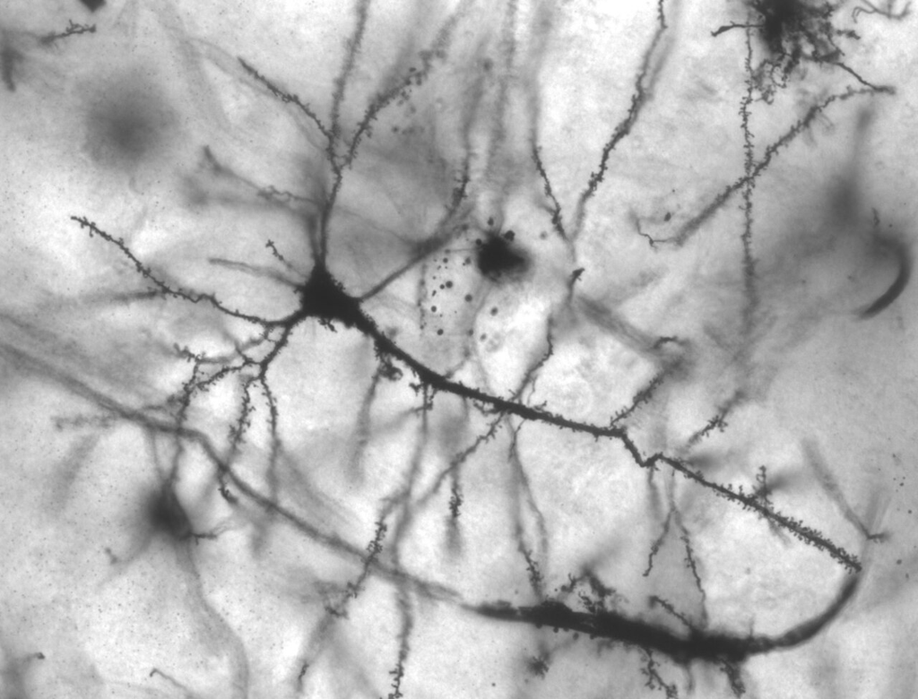 Hippocampal Pyramidal Neuron — Golgi Stain 40×