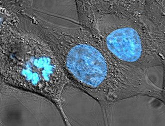HeLa Cells — Hoechst Fluorescence Stain