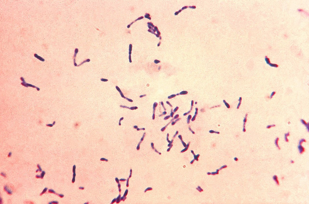 Corynebacterium diphtheriae — Gram Stain