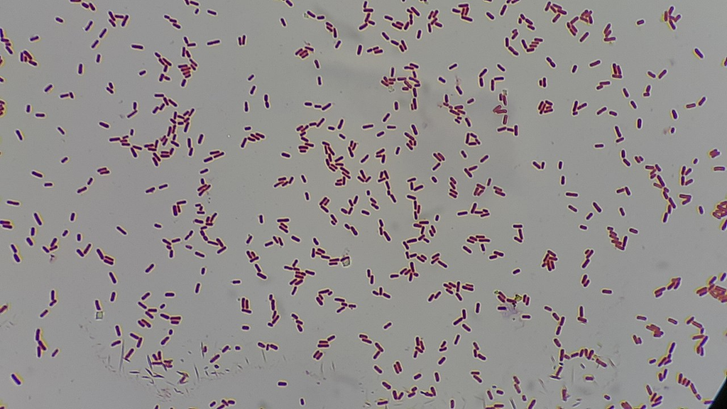 Klebsiella pneumoniae — Gram Stain