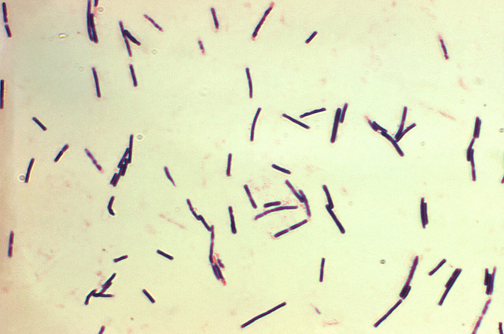 Clostridium perfringens — Gram Stain