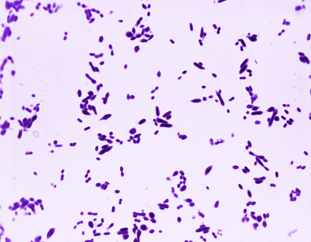 Streptococcus pneumoniae — Gram Stain