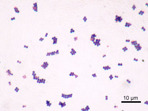 Staphylococcus aureus — Gram Stain