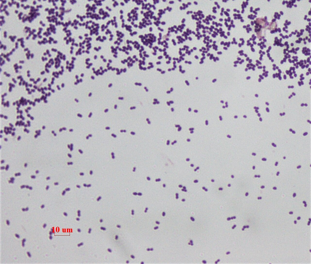 Enterococcus faecalis — Gram Stain