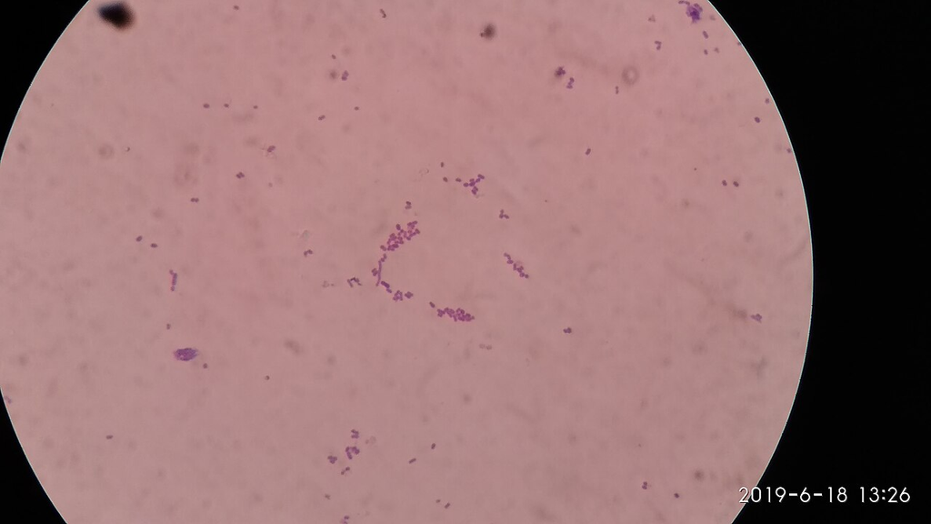 Listeria monocytogenes — Gram Stain
