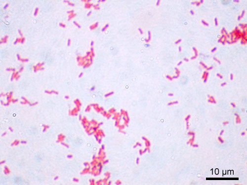 Escherichia coli — Gram Stain