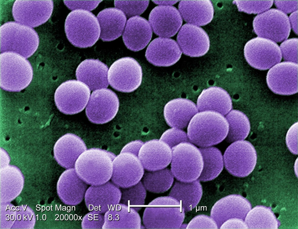Staphylococcus aureus — TEM Ultrastructure