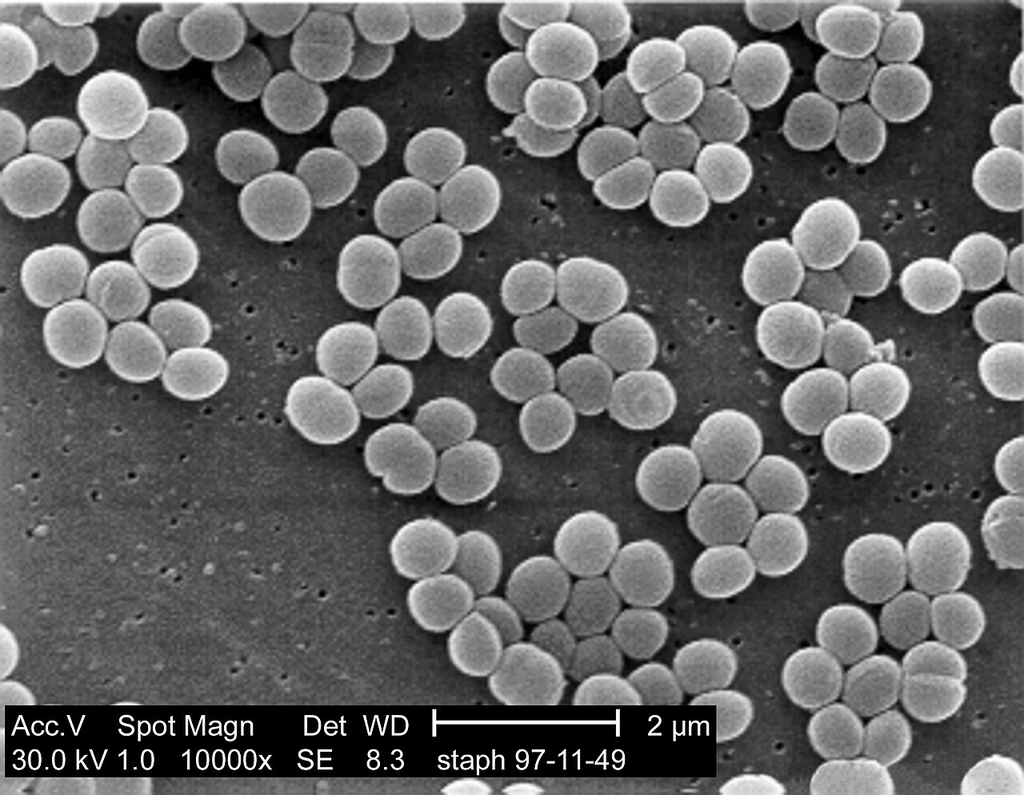 Staphylococcus aureus — Electron Micrograph