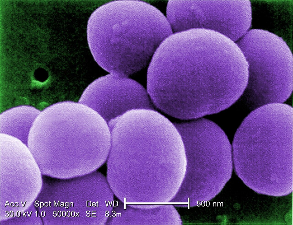 Staphylococcus aureus — TEM Cross Section