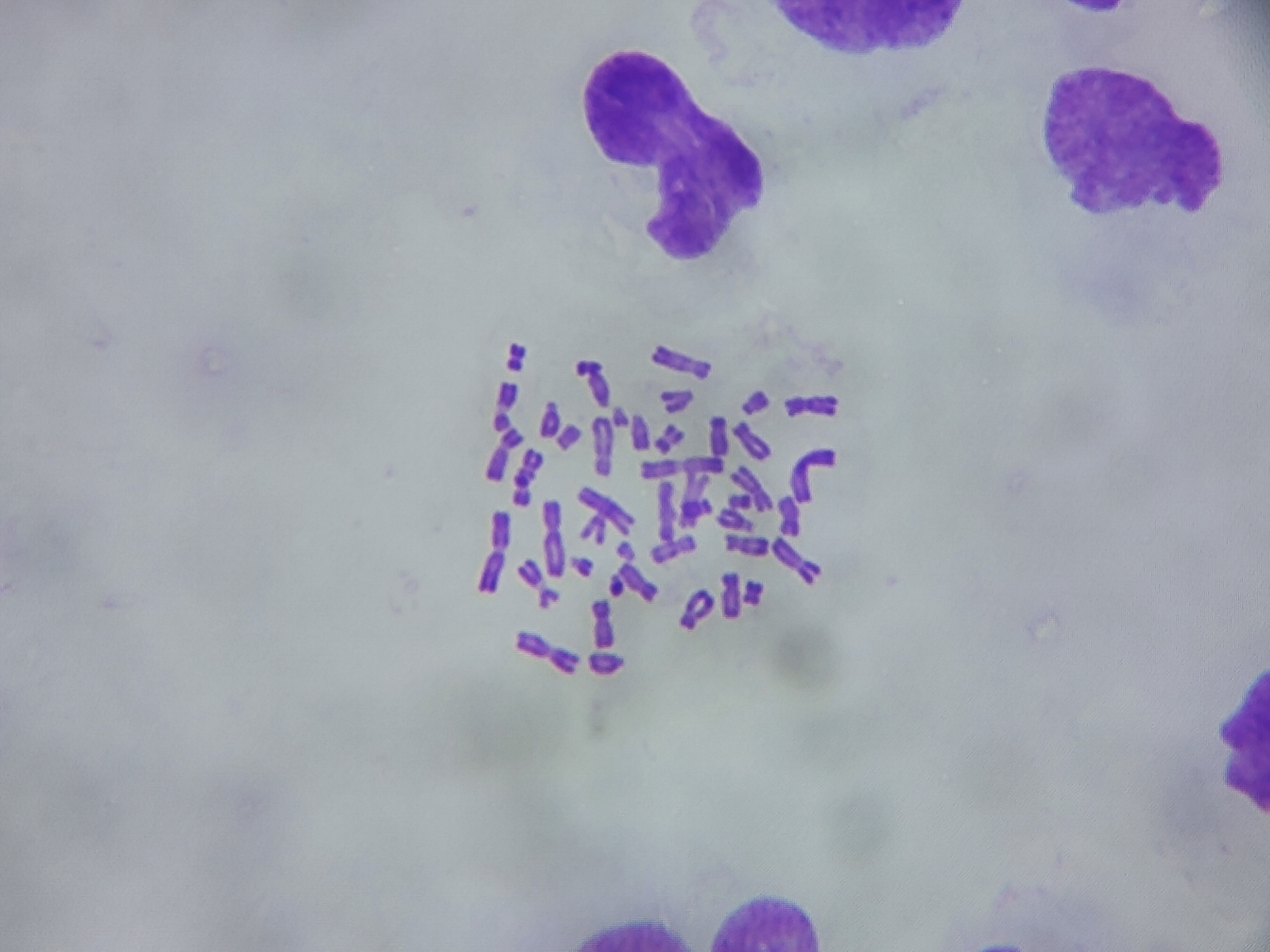 Human Metaphase Chromosome Spread — Brightfield