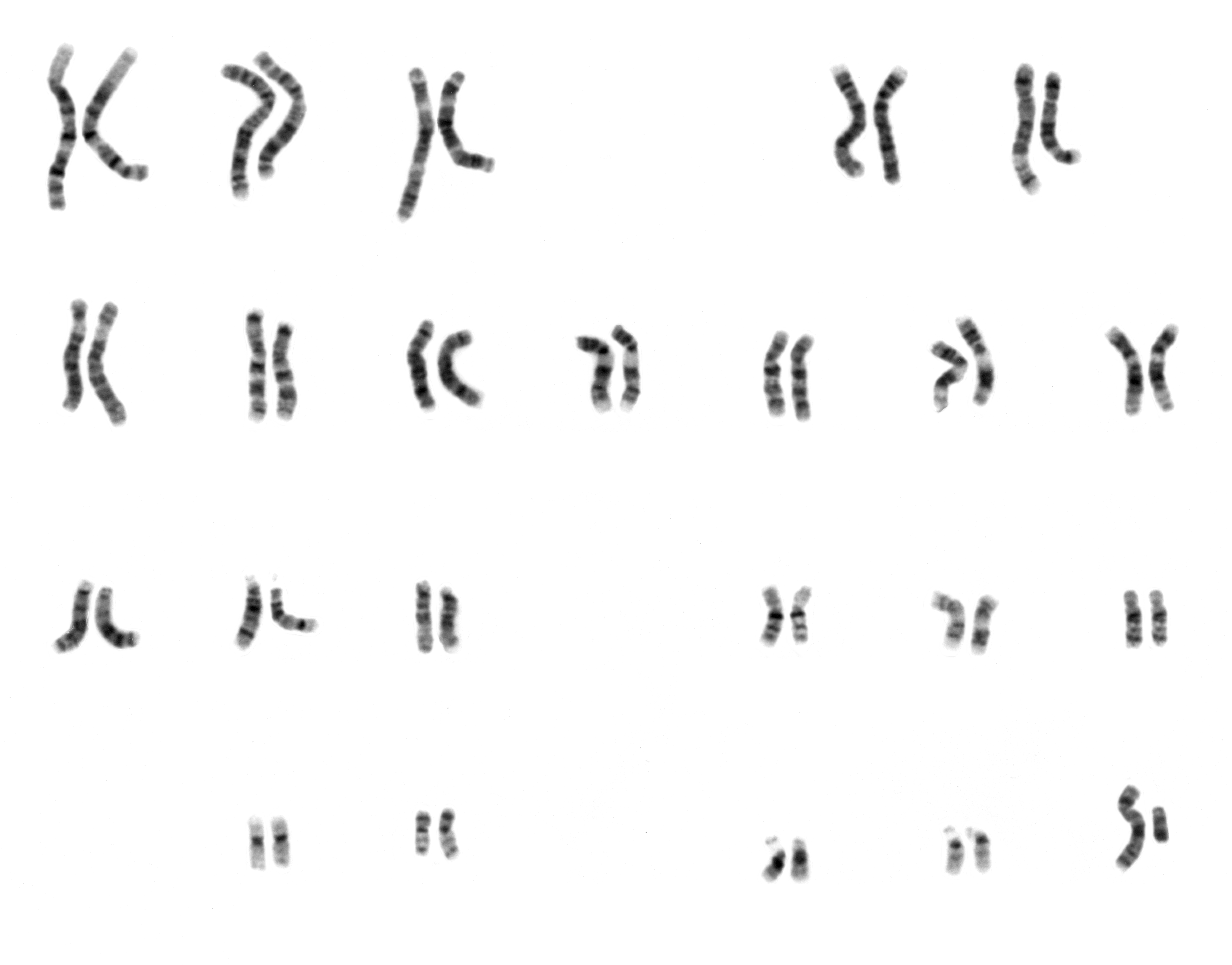 Human Male Karyotype — G-Banded Chromosomes