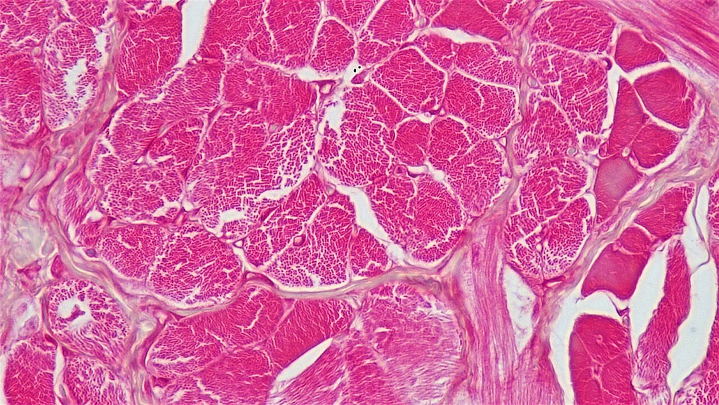 Skeletal Muscle — Cross-Section H&E