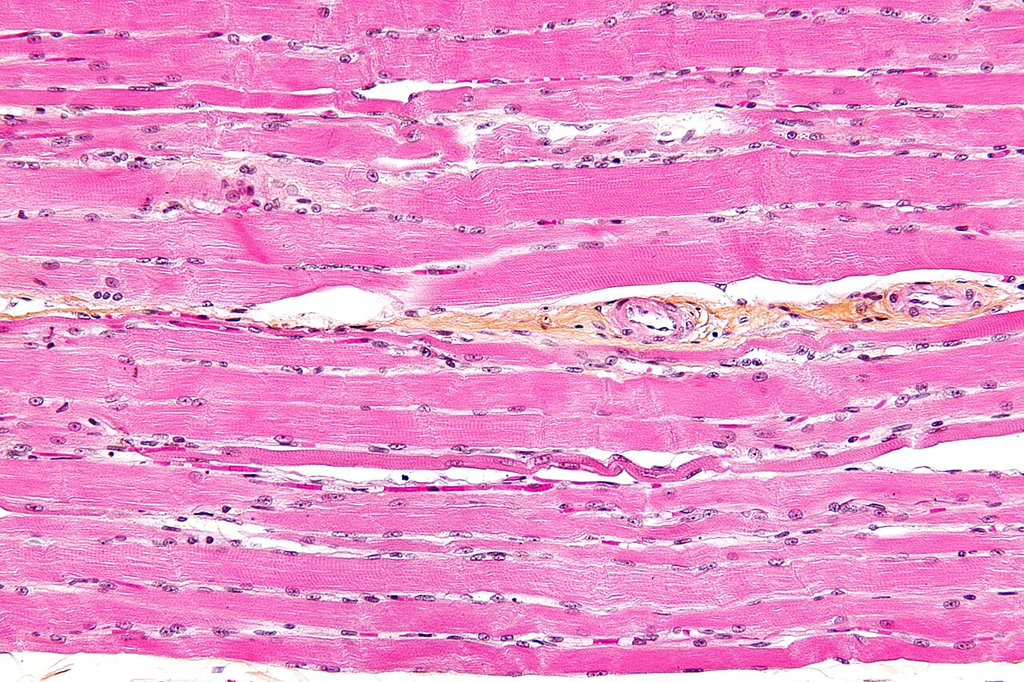 Striated Skeletal Muscle — H&E Detail