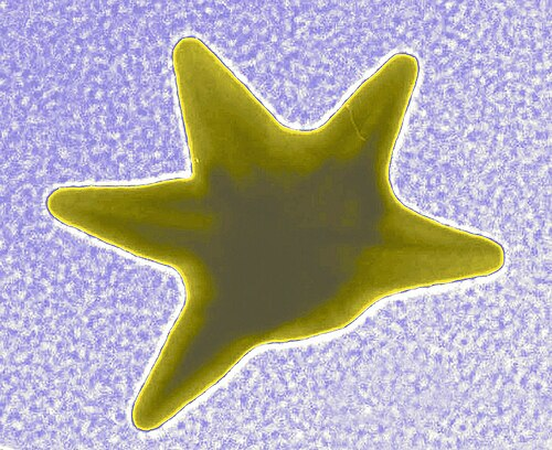 Gold Nanostars â€” TEM