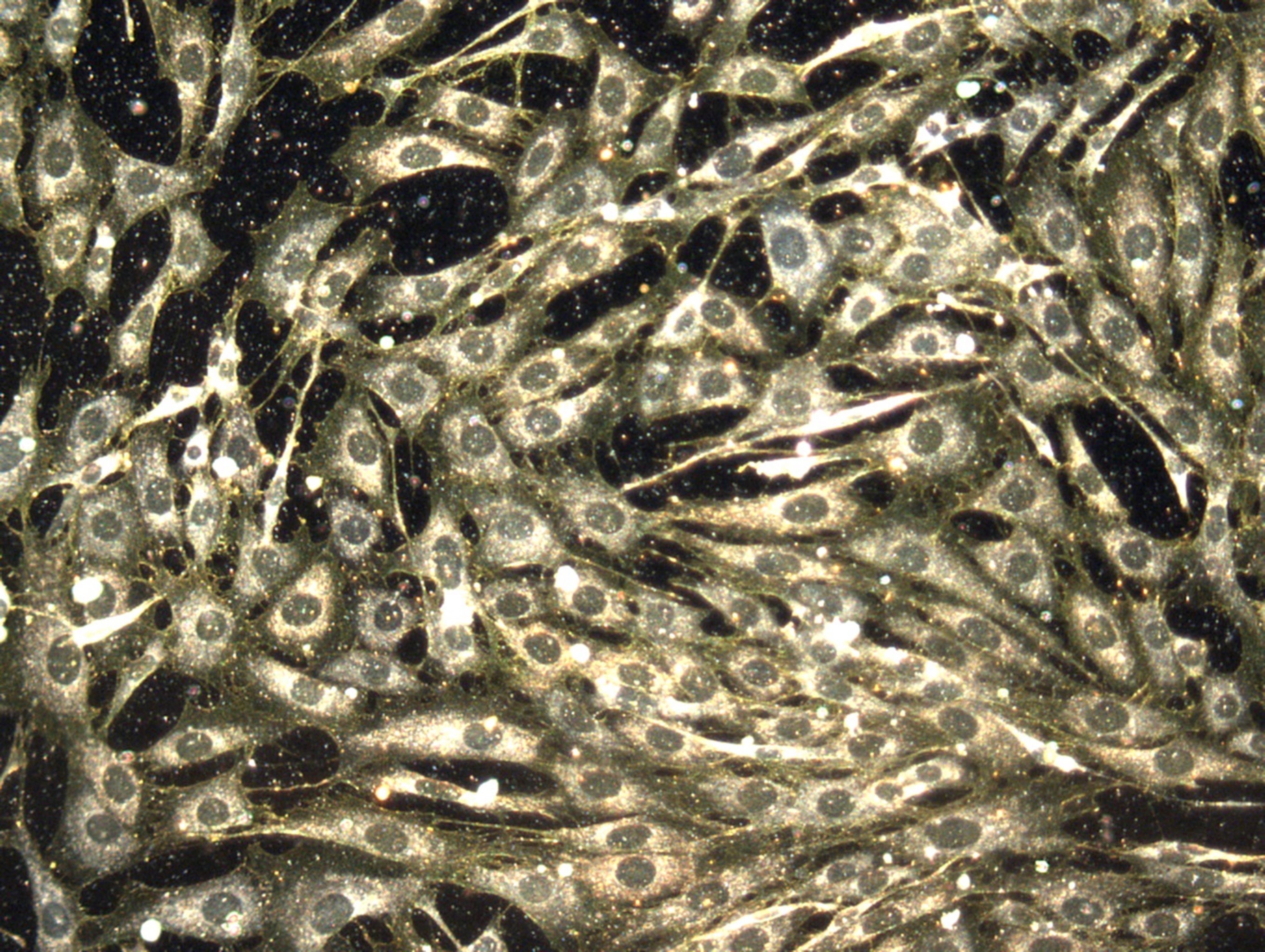 Gold Nanoparticles in Cell Cytosol — TEM