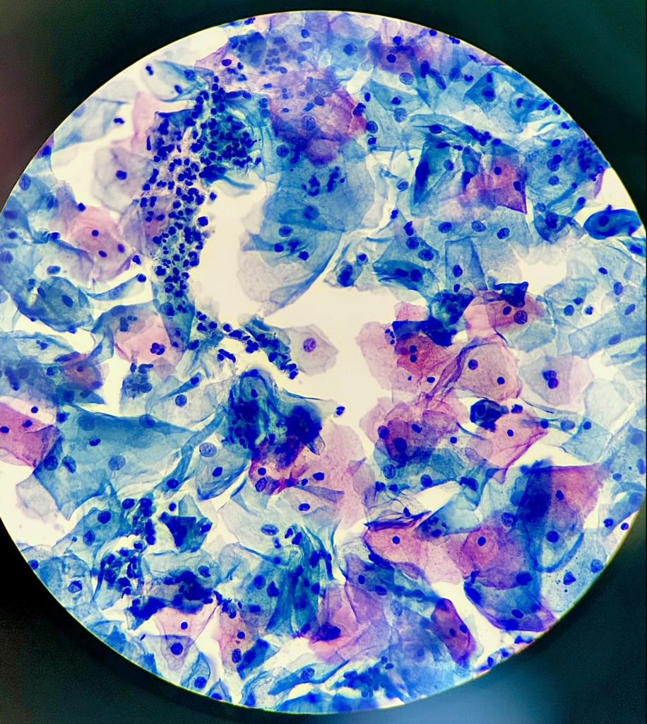 Cervical Cytology — Pap Stain