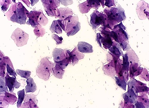 Normal Pap Smear — Papanicolaou Stain
