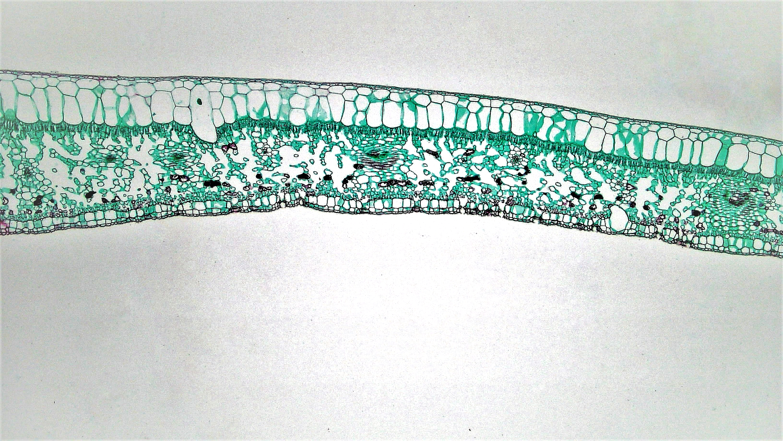Ficus Leaf Cross-Section — Xerophytic Dicot Anatomy