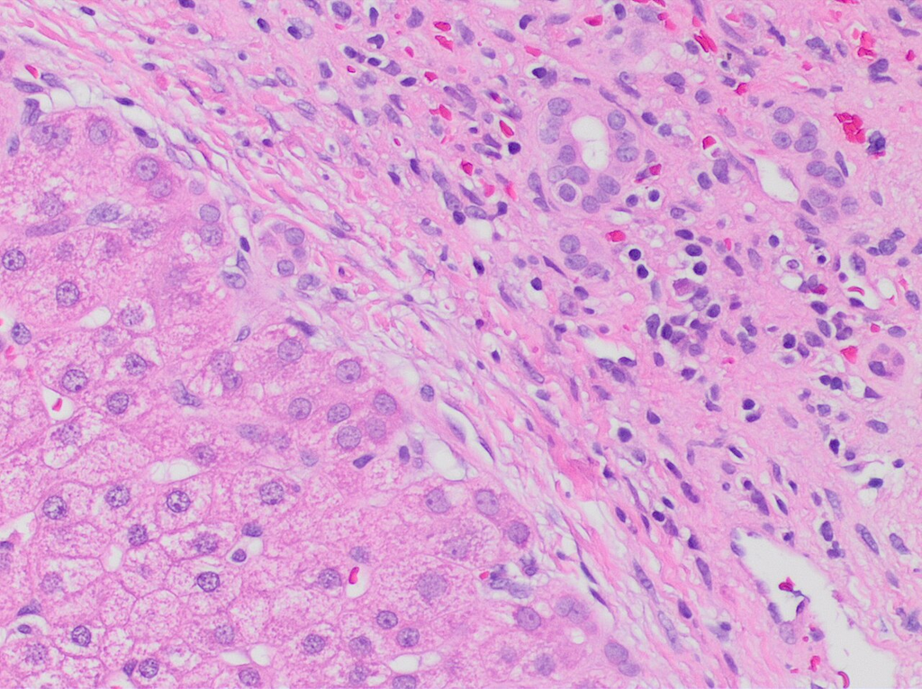 tissue_he__he__20809b80ae46