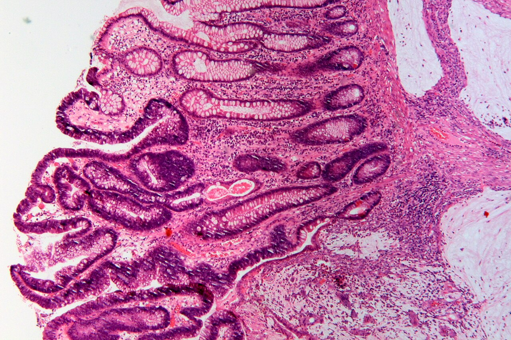 tissue_he__he__74c5cce52524