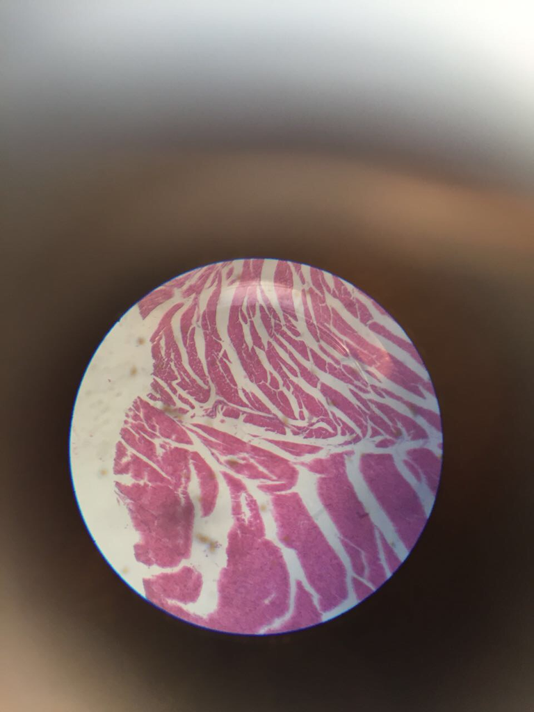 Cardiac Muscle Tissue — H&E Section