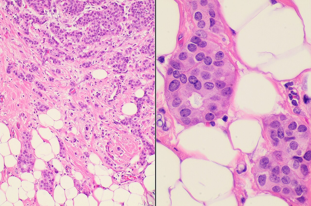 tissue_he__he__876cf266f174